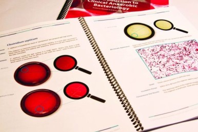 Practical Guide to Clinical Anaerobic Bacteriology