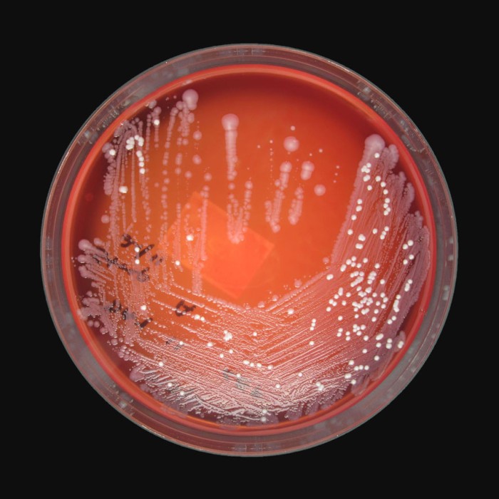 Want to photograph Petri dishes during incubation? Well now you can