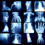 x-rays